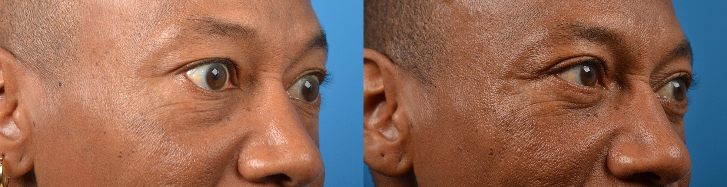 Before & After Photos | Clevens Face & Body Specialists in Florida